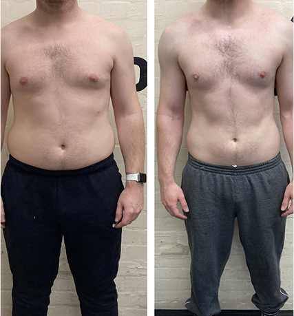 before-after-image